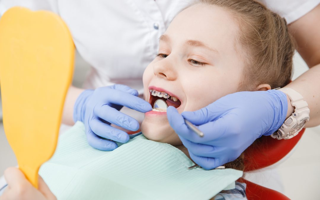 How to Prepare Your Child for Braces for Kids: A Parent’s Guide
