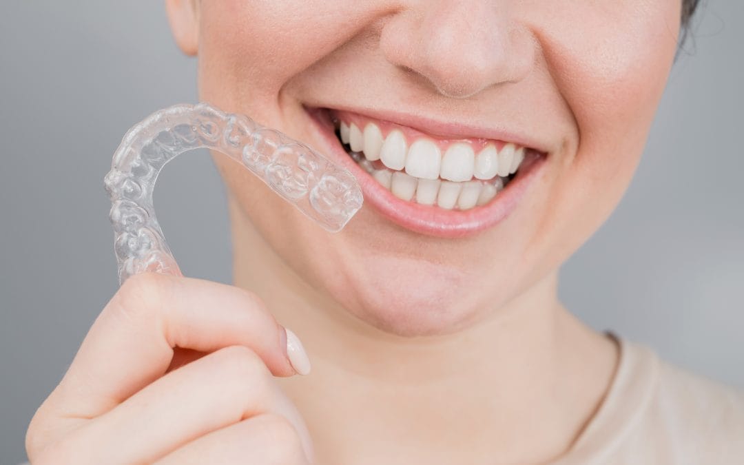 Clear Aligners in Gardena? What to Expect From Your First Visit