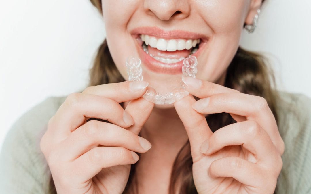 Clear Aligners in Los Angeles County: A Straighter Smile Without the Metal