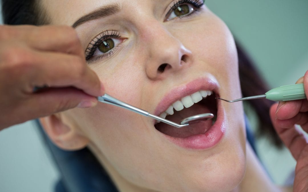 How Deep Cleaning & Scaling Help Safeguard Your Gums from Advanced Gum Disease