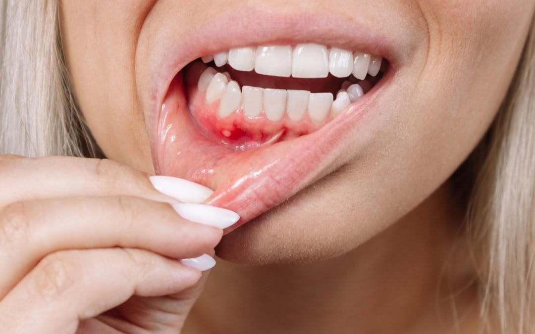 Gum Disease Warning Signs Every Patient Should Know