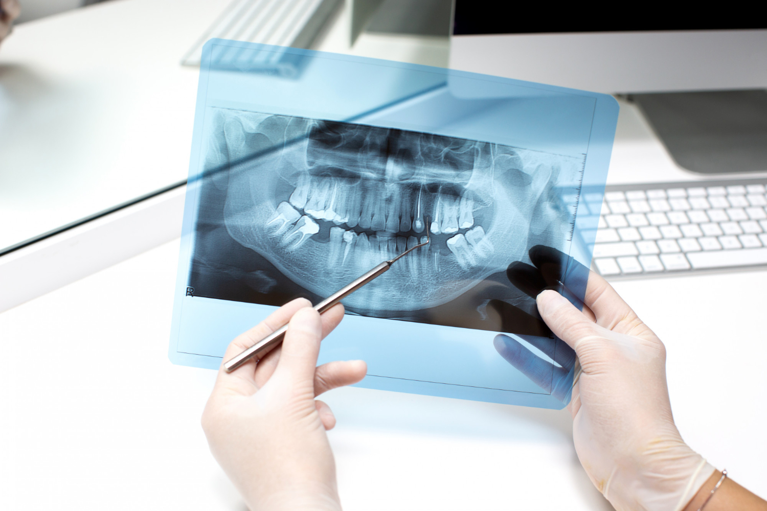 Gloved hands hold a dental X-ray and point to teeth with a tool in a medical office setting.