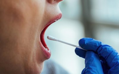 What Is an Oral Cancer Screening? What Gardena Patients Should Know