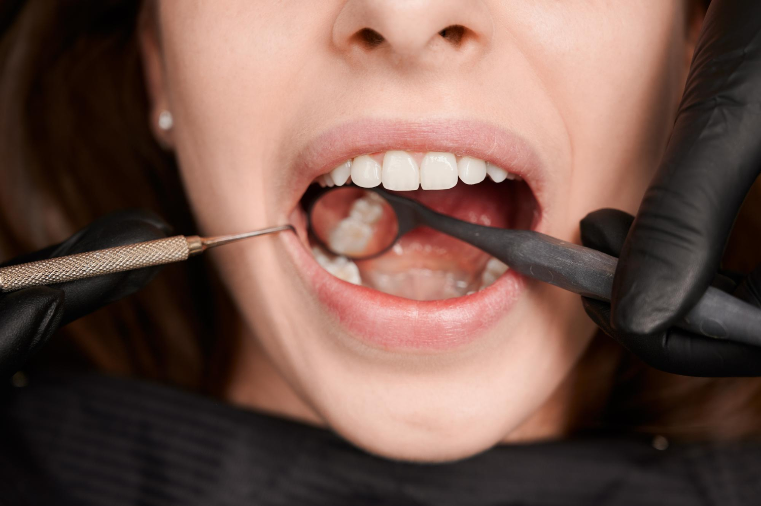 A dentist examines a patient’s open mouth using dental tools and wearing black gloves.